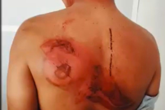 Agencia Nacional de Tierras rechaza la escalada de violencia que, en los últimos días, ha golpeado a comunidades rurales beneficiarias de la Reforma Agraria.