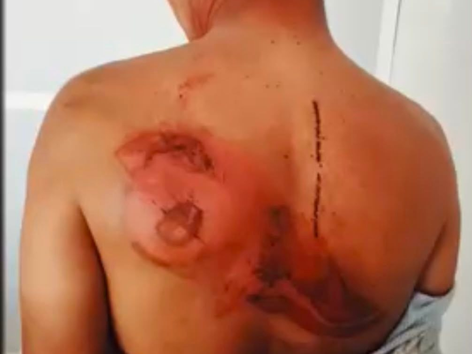 Agencia Nacional de Tierras rechaza la escalada de violencia que, en los últimos días, ha golpeado a comunidades rurales beneficiarias de la Reforma Agraria.